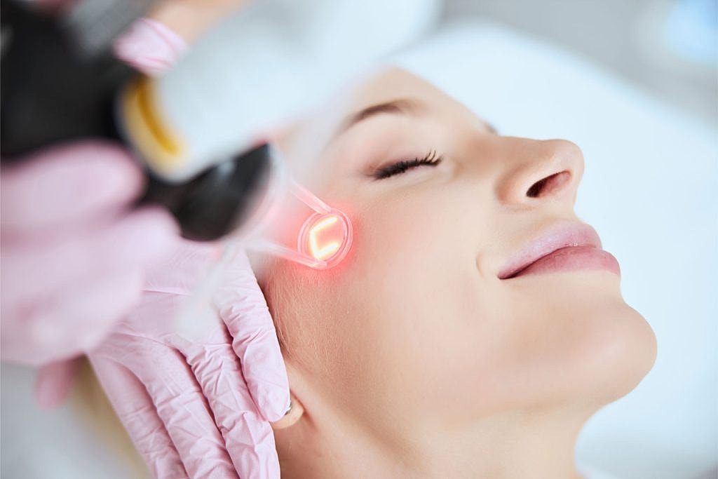Why Women in Los Angeles Are Choosing CO2 Laser Over Facials for Skin Tightening