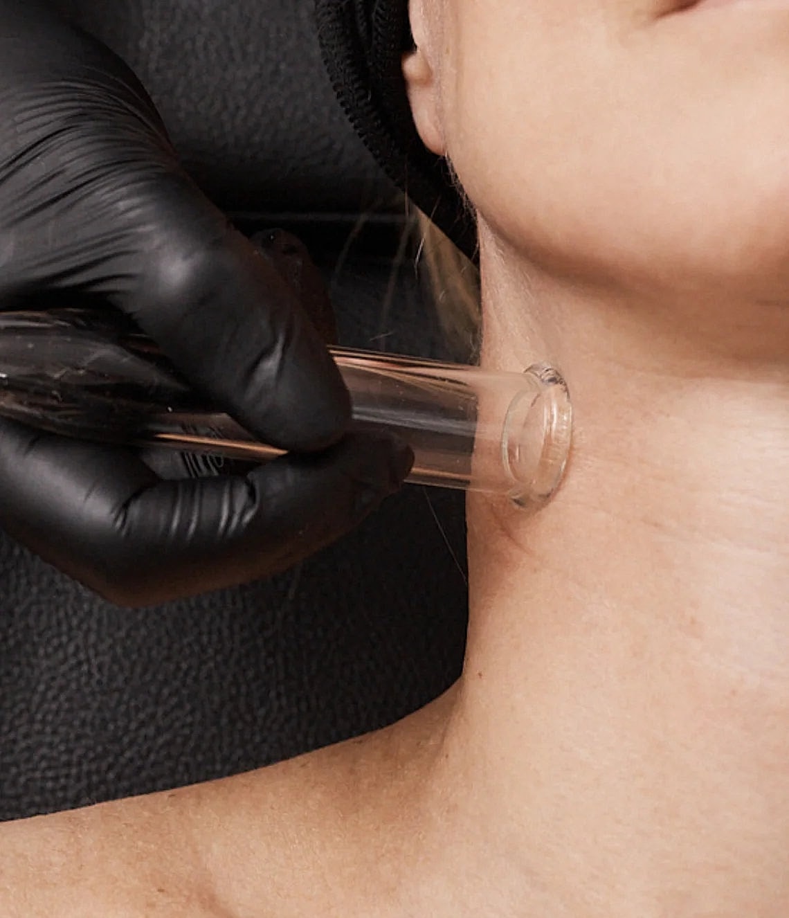 Lymphatic Therapy